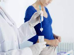 Cervical Screening