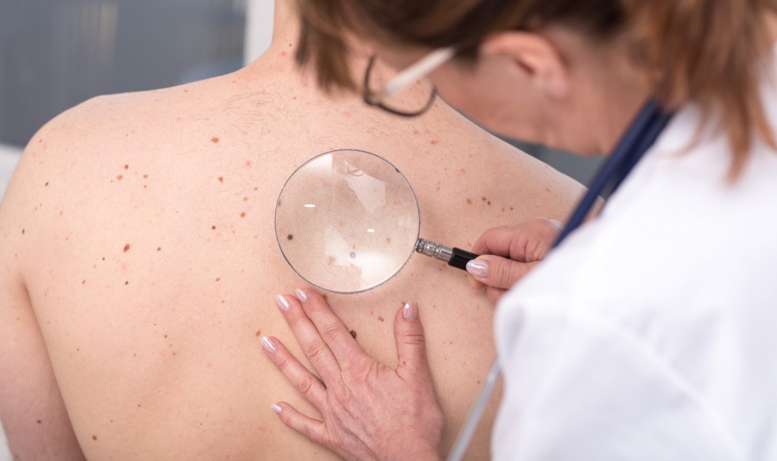 Skin Check